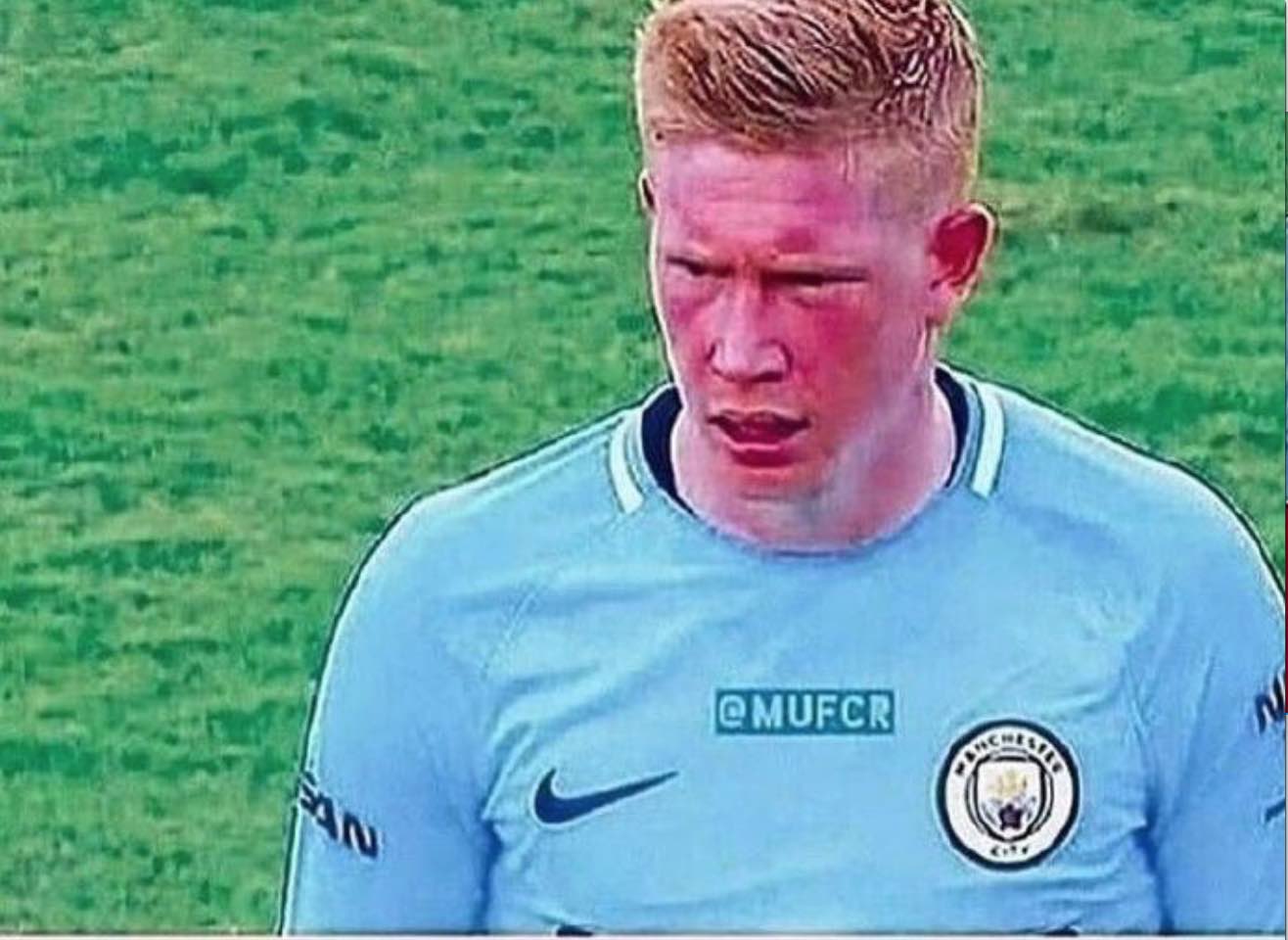 补强方向 补强方向